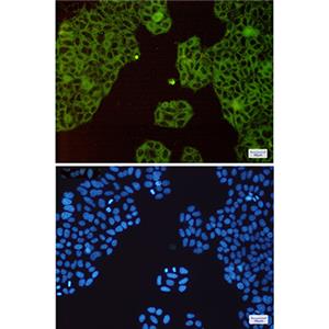 c-Met兔单抗,c-Met Rabbit Monoclonal Antibody