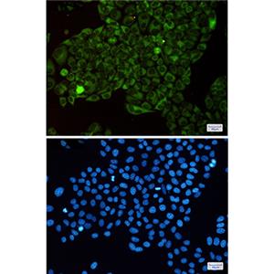 MetRS兔单抗,MetRS Rabbit Monoclonal Antibody