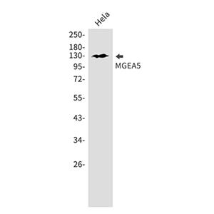 OGA兔单抗,OGA Rabbit Monoclonal Antibody