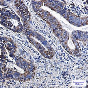 MGST3兔单抗,MGST3 Rabbit Monoclonal Antibody