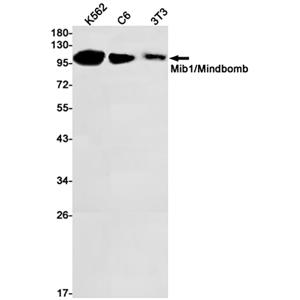 MIB1兔单抗,MIB1 Rabbit Monoclonal Antibody