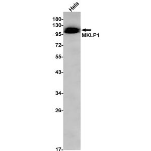 MKLP1兔单抗,MKLP1 Rabbit Monoclonal Antibody