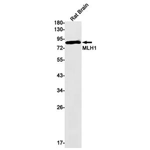 MLH1兔单抗,MLH1 Rabbit Monoclonal Antibody