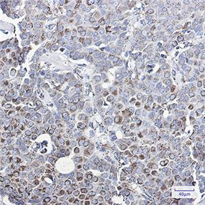 MMP3兔单抗,MMP3 Rabbit Monoclonal Antibody
