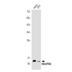 NDUFB2兔单抗,NDUFB2 Rabbit Monoclonal Antibody