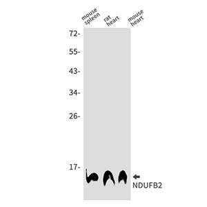 NDUFB2兔单抗,NDUFB2 Rabbit Monoclonal Antibody