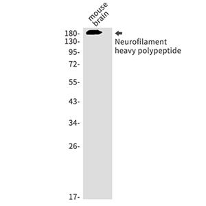 Neurofilament Heavy Polypeptide Rabbit Monoclonal Antibody | 兔单抗 | EnkiLife恩玑生命
