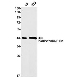 PCBP2兔单抗,PCBP2 Rabbit Monoclonal Antibody