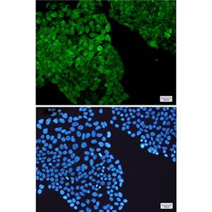 PGK1兔单抗,PGK1 Rabbit Monoclonal Antibody