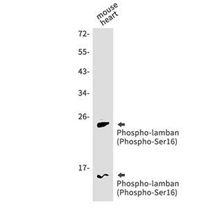 Phospho-Phospholamban (Ser16)兔单抗,Phospho-Phospholamban (Ser16) Rabbit Monoclonal Antibody