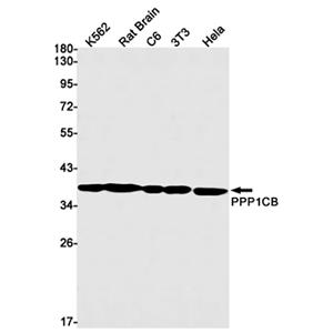 PP1C beta兔单抗,PP1C beta Rabbit Monoclonal Antibody