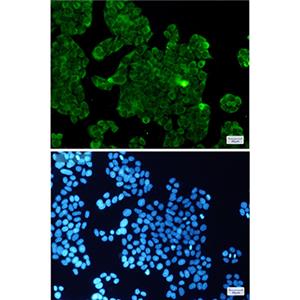 PP1C beta兔单抗,PP1C beta Rabbit Monoclonal Antibody