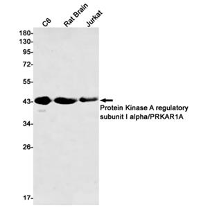 PKA RI alpha兔单抗,PKA RI alpha Rabbit Monoclonal Antibody