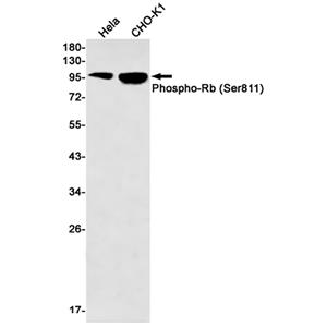 Phospho-Rb (Ser811)兔单抗,Phospho-Rb (Ser811) Rabbit Monoclonal Antibody