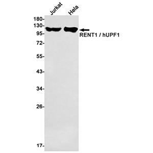 RENT1兔单抗,RENT1 Rabbit Monoclonal Antibody