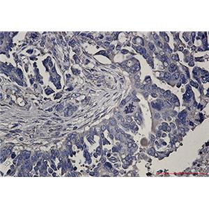 RENT1兔单抗,RENT1 Rabbit Monoclonal Antibody