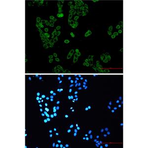 RENT1兔单抗,RENT1 Rabbit Monoclonal Antibody