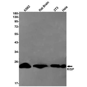 Complex III Subunit 5兔单抗,Complex III Subunit 5 Rabbit Monoclonal Antibody