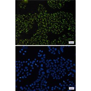 Complex III Subunit 5兔单抗,Complex III Subunit 5 Rabbit Monoclonal Antibody