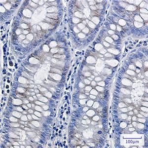 Complex III Subunit 5兔单抗,Complex III Subunit 5 Rabbit Monoclonal Antibody