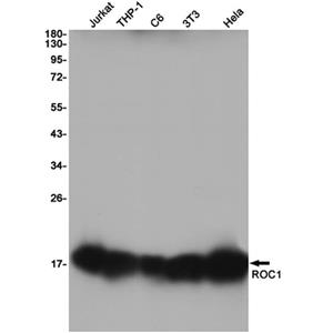 RBX1兔单抗,RBX1 Rabbit Monoclonal Antibody