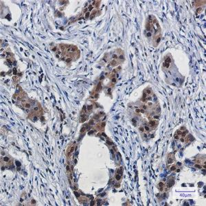 RBX1兔单抗,RBX1 Rabbit Monoclonal Antibody