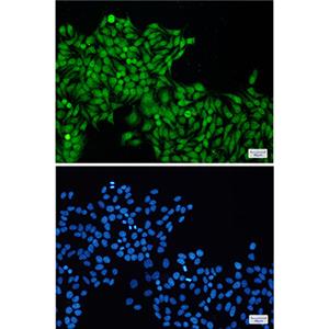 RBX1兔单抗,RBX1 Rabbit Monoclonal Antibody