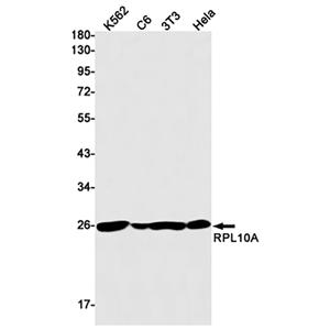 RPL10A兔单抗,RPL10A Rabbit Monoclonal Antibody