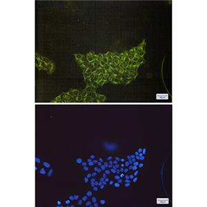 S6K1兔单抗,S6K1 Rabbit Monoclonal Antibody