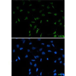SFPQ兔单抗,SFPQ Rabbit Monoclonal Antibody