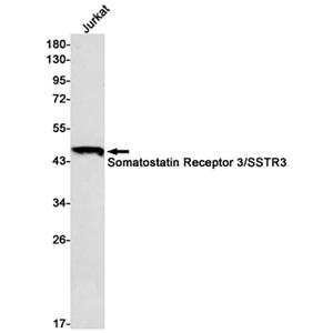 Somatostatin Receptor 3兔单抗,Somatostatin Receptor 3 Rabbit Monoclonal Antibody