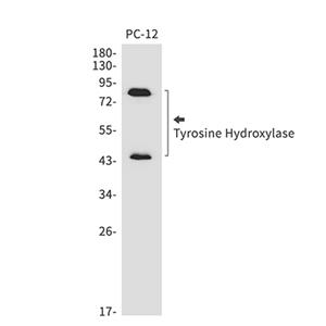 Tyrosine Hydroxylase兔单抗,Tyrosine Hydroxylase Rabbit Monoclonal Antibody