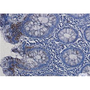 VDAC1兔单抗,VDAC1 Rabbit Monoclonal Antibody