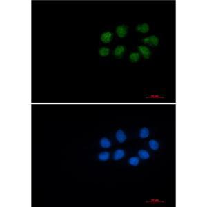 Phospho-Vimentin (Ser56)兔单抗,Phospho-Vimentin (Ser56) Rabbit Monoclonal Antibody