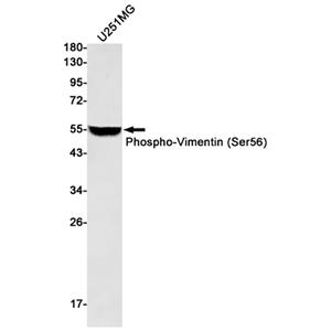 Phospho-Vimentin (Ser56)兔单抗,Phospho-Vimentin (Ser56) Rabbit Monoclonal Antibody