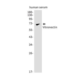 Vitronectin兔单抗,Vitronectin Rabbit Monoclonal Antibody