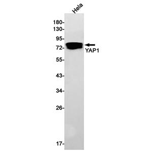 YAP1兔单抗,YAP1 Rabbit Monoclonal Antibody