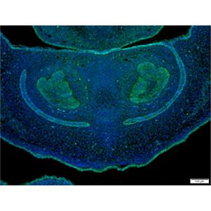 YAP1兔单抗,YAP1 Rabbit Monoclonal Antibody