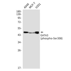 Phospho-GATA3 (Ser308) Rabbit Monoclonal Antibody | 兔单抗 | EnkiLife恩玑生命