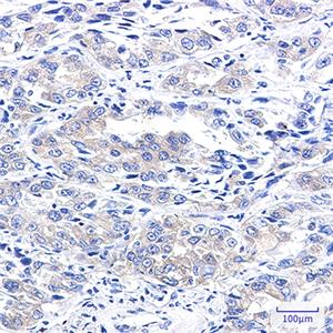 A RAF兔单抗,A RAF Rabbit Monoclonal Antibody