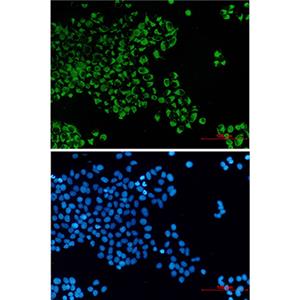 Bcl2 L14兔单抗,Bcl2 L14 Rabbit Monoclonal Antibody