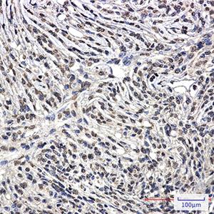 Bcr兔单抗,Bcr Rabbit Monoclonal Antibody