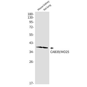 CAB39兔单抗,CAB39 Rabbit Monoclonal Antibody