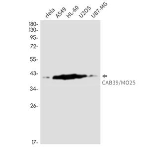 CAB39兔单抗,CAB39 Rabbit Monoclonal Antibody
