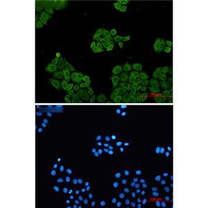 CLIC1兔单抗,CLIC1 Rabbit Monoclonal Antibody