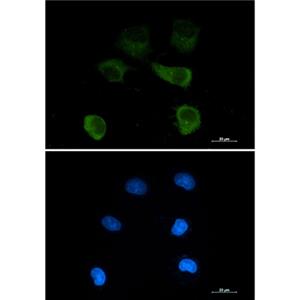 gamma Tubulin兔单抗,gamma Tubulin Rabbit Monoclonal Antibody