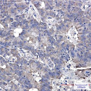 Hsp90 beta兔单抗,Hsp90 beta Rabbit Monoclonal Antibody