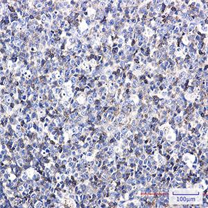 ICAM3兔单抗,ICAM3 Rabbit Monoclonal Antibody