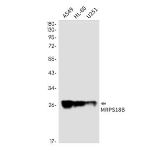 MRPS18B兔单抗,MRPS18B Rabbit Monoclonal Antibody