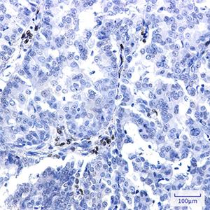NR2F2兔单抗,NR2F2 Rabbit Monoclonal Antibody